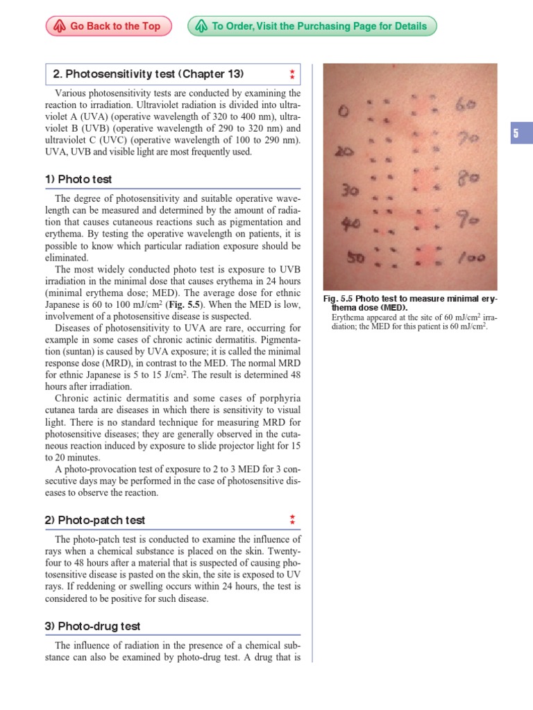 Photosensitivity Test (Chapter 13) : Go Back To The Top | PDF | Allergy ...