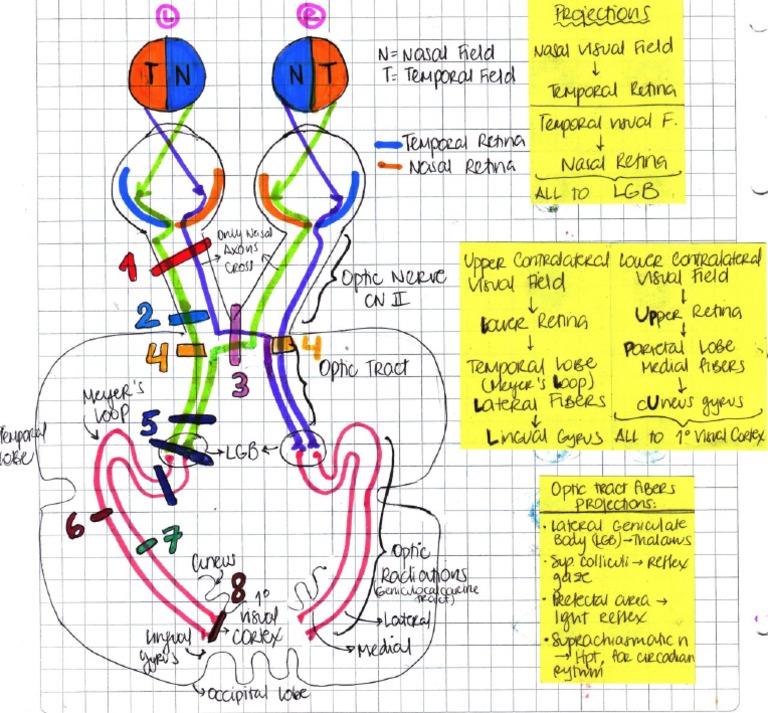 Lesiones Del Nervio Optico