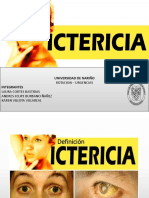 Exposicion Ictericia