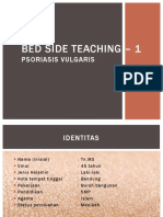 BST Astrid - Psoriasis Vulgaris