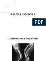 FRAKTUR PATOLOGIS.pptx