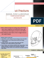 BLOW OUT FRACTURE FIRDHA.pptx