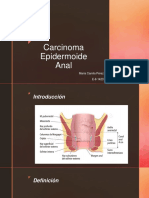 Carcinoma Epidermoide Anal