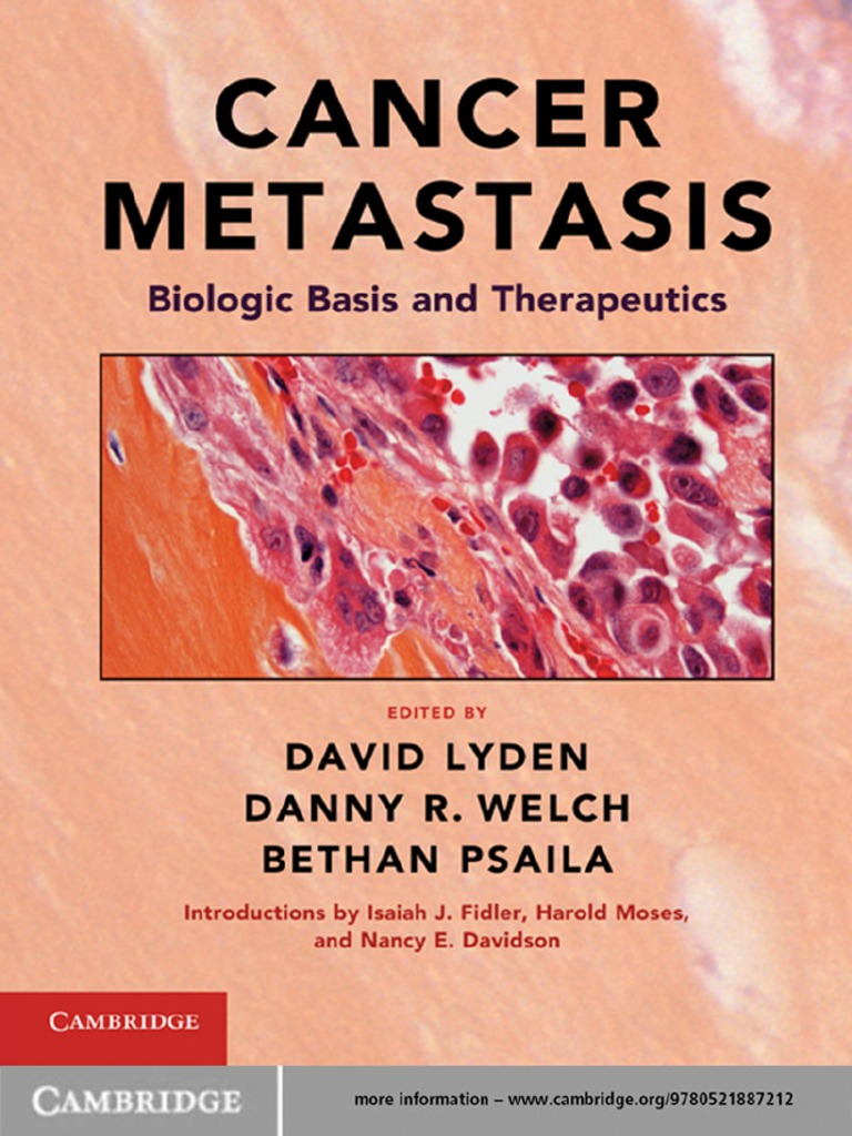 Cancer Metastasis PDF | PDF | Metastasis | Cancer