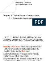 Chapter 3. Clinical Forms of Tuberculosis 3.1. Tubercular Intoxication