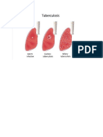 Salinan Terjemahan Clinical Characteristics of Peptic Ulcer Perforation in Korea Terjemah