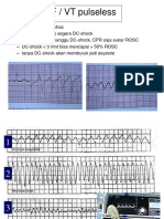 DC Shock Ekg (Perawat)