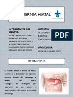 Hernia Hiatal