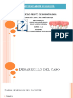 Poste de Fibra de Vidrio Con Corona de Disilicato de Litio