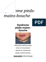 Syndrome Pieds-Mains-Bouche - Wikipédia