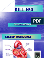 Ekg Skill 119