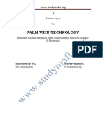 Palm Vein Authentication: A Secure Biometric Technology