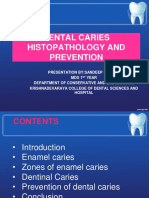 Dental Caries Histopathology and Prevention