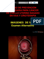 Curso prevención cáncer cuello uterino IVAA crioterapia