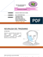 Neuralgia Del Trigémino