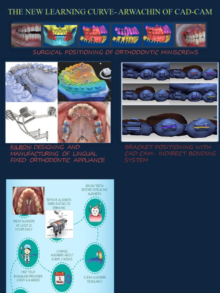 Kilbon Orthodontics: CAD-CAM Innovations | PDF | Orthodontics | Materials