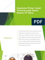 Glaukoma Primer Sudut Tertutup Pada Pasien Wanita 39 Tahun