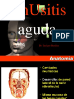 Sinusitis Aguda v9