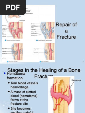 Bone Healing