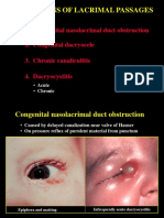 08infection Lacrimal
