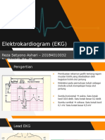 EKG Reza