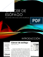 Cáncer de Esófago