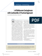 Mulluscum Contagiosum Cantharone Article PDF
