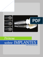Manual Implante Dalton PDF