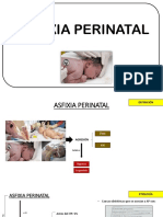 Asfixia Perinatal