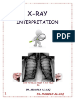 X-Ray Interpretation PDF