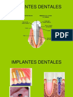 6-CLASE - 2 Implates Complemento PDF