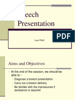 Breech Presentation: Lucy Pettit