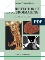 Evelyn M. Teasdale, Susan Aitken-Multidetector CT in Neuroimaging - An Atlas and Practical Guide-Clinical Publishing Services (2009) PDF