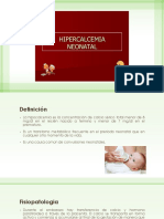 Hipocalcemia