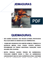 QUEIMADURAS.ppt