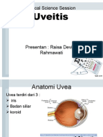 CSS Uveitis