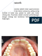 Parateeth dan Suplemental Teeth