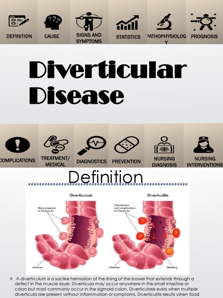 Diverticular Disease PDF Constipation Digestive Diseases