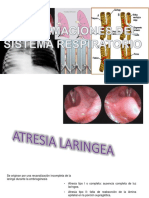 Malformaciones pulmonares congénitas menos de