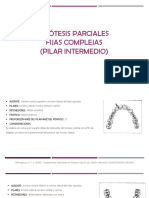 Configuracion de La Protesis Parcial Fija