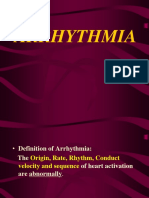 ARRHYTHMIA