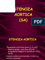 stenoza