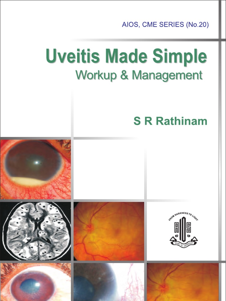 Uveitis Workup and Management Guide | PDF | Glaucoma | Medical Diagnosis