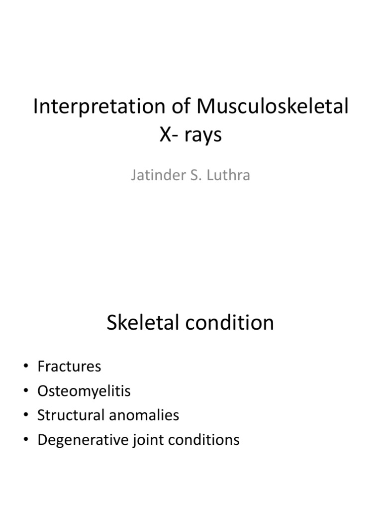 Interpretation of Musculoskeletal XRays Jatinder S. Luthra PDF