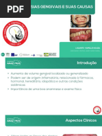 LIGA LADO - Hiperplasias Gengivais e Suas Causas