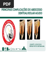 LIGA LADO - Complicações Do Abscesso Dentoalveolar Agudo