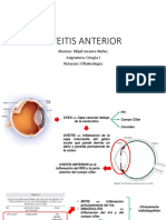 Uveitis Anterior Expo Miercoles