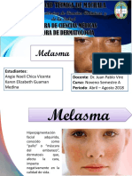 Melasma Presentacion