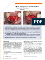 Case Series: The Use of Enamel Matrix Derivative in Two-Stage Guided Bone Regeneration Procedures