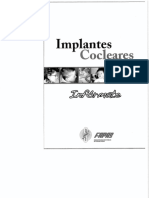 implantes cocleares